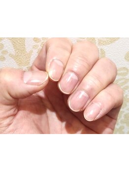 爪の悩みを解消できる（ケア含む）