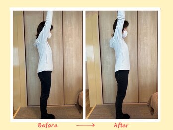 アイノテ メディカルボディケア(Ainote medical body care)/［肩関節の施術例紹介］