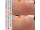 クラルテアンドコー(Salon Clarte&Co.)の写真
