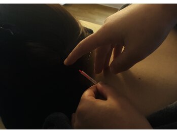 鍼灸院 楽(gaku)の写真/デスクワークやストレスで凝り固まった肩こり・首こりにアプローチ♪睡眠の質サポートなども見込めます。