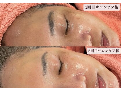 シャイニー(Shiny)の写真