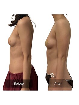 ベンザイ 新潟店(BENZAI)/生理前は体重が増えちゃう人