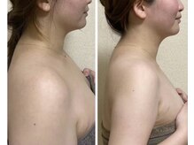 ヨサパーク ルポ(YOSA PARK ropos)/別人級