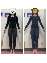 いわき美容整体院/痩身骨盤矯正　産後の骨盤矯正