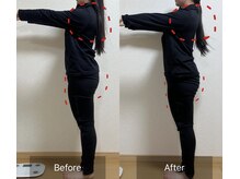 ヨサパーク ウイ(YOSA PARK Ui)/20代女性before/after