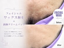 アイラッシュ リリオ(Lirio)/お肌のくすみの原因は産毛！？