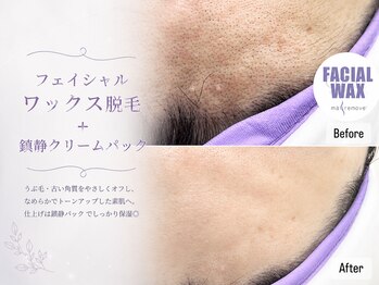 アイラッシュ リリオ(Lirio)/お肌のくすみの原因は産毛！？