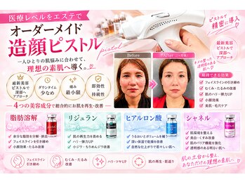 ルアナ(Luana)の写真/韓国美容【お肉溶解液をピストルで撃退】ク○ニック級をエステで！即効性◎ブルドッグフェイス、小顔に