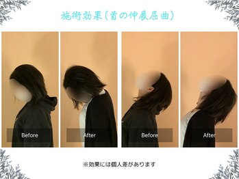 ボディ リセット アンド デザイン(Body Reset & Design)/【施術例】ビフォーアフター