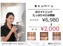 ホワイトニングショップ 越谷店