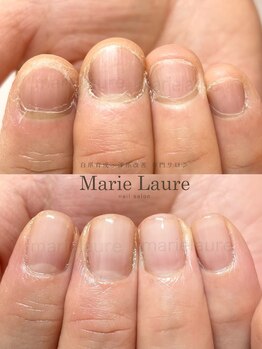 マリーロール 梅田店(Marie Laure)/深爪改善/自爪育成/ネイルケア