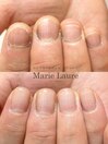 深爪改善/自爪育成/ネイルケア