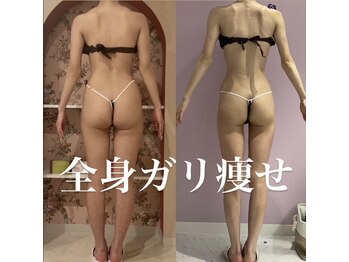 メルローズ 自由が丘店(Melrose)/【お客様の効果写真】