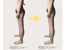 ネオボディ(Neo Body)/ビフォーアフター