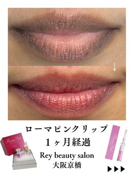 レイ(Rey)/ローマピンクリップ1か月症例