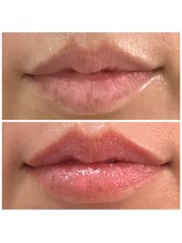 ビースキン(be-skin)/くすみケアbefore→after