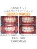 【初回限定】黄ばみが気になる方に◎セルフホワイトニング30分体験