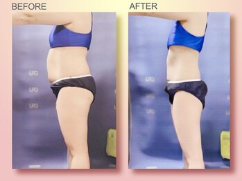 ジュリア オージェ 四条河原町店/ ビフォーアフター（サーモ)