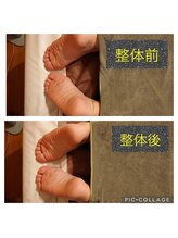 リベラ(LIBERA)/背面をほぐしただけ★