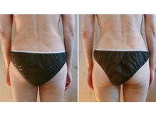 サプナジー(Suppnrgy)/カスタムトリートメント