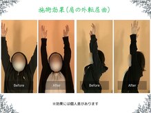 ボディ リセット アンド デザイン(Body Reset & Design)/【施術例】ビフォーアフター