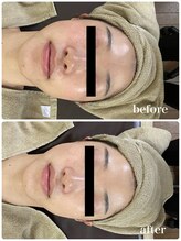 ジャスミン(Jasmin)/モイスチャーフェイシャル