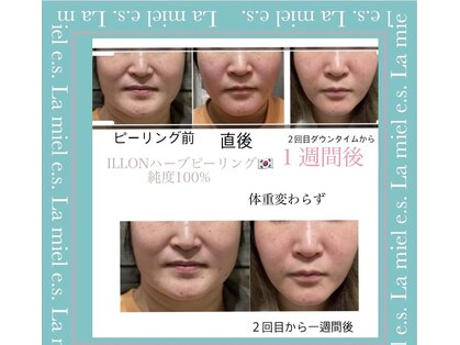 ラ ミュエル(La miel)の写真