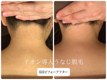 リノ(Lino)/うなじ脱毛シェービング付き♪
