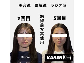 クリアランス 南青山(CLEARANCE)/施術回数5回　KAREN担当