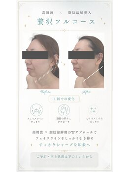 エフリア 大垣(F.lia)/引き締まり若見え効果抜群★