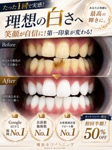博多ホワイトニング福岡 小倉駅前店&nbsp;ホワイト BeforeAfer