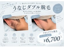 サリエ(S'allier)の雰囲気（人気No.2の『うなじダブル脱毛』）