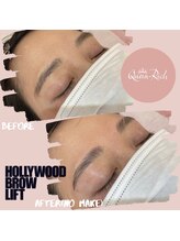 クィーンリッチ(Queen-Rich)/美眉【ハリウッドブロウリフト】