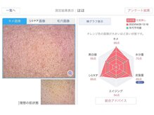 アリエス/肌解析機　iPas