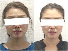 美容整体 ウェリナ 蟹江院/小顔矯正/骨盤矯正/美脚サロン