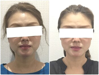 美容整体 ウェリナ 蟹江院/小顔矯正/骨盤矯正/美脚サロン