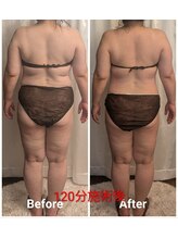 フィニシオン/50代120分施術