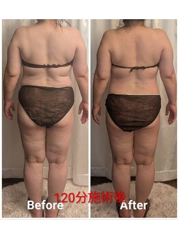 フィニシオン/50代120分施術