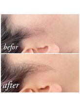 ティアル 赤坂(tiarl)/もみあげシェービング