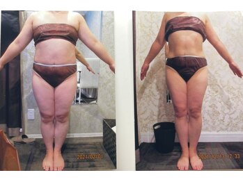 パーフェクトボディプレミアム 大阪梅田店(PERFECT BODY PREMIUM)/お客様　ビフォーアフター（9）