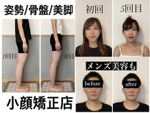 お写真を見てご説明します。小顔も姿勢も◎男性も可能です