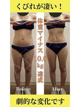 エアリアル 中津店/3ヶ月集中ダイエットプログラム