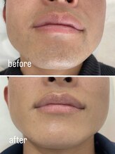 グランツ(GLANZ)/