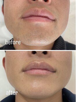 グランツ(GLANZ)/