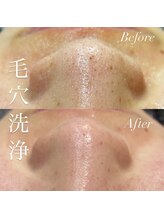 アース コアフュールボーテ 新潟紫竹山店(EARTH coiffure beaute)/毛穴洗浄