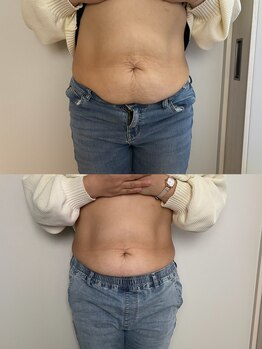 レアレア(Lea l'ea)/