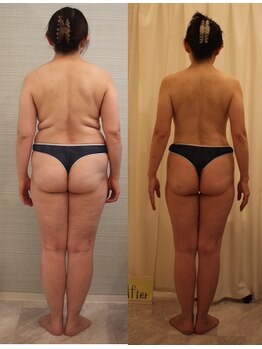 ファニービー 茨木本店/Before→After