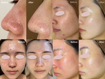 ミーラヤ(MILAYA)