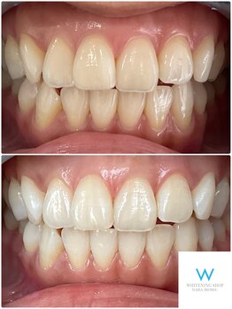 ホワイトニングショップ 奈良生駒店/メンテナンスの大切さ