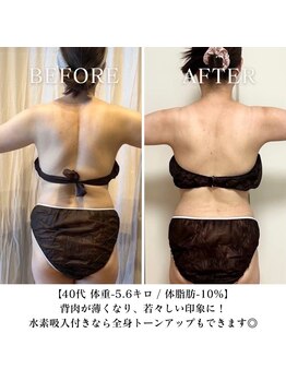 ヨサパーク エラ 恵比寿西(YOSA PARK Ella)/ダイエット卒業コース